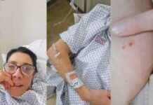 Hospitalizan a Cynthia Klitbo por mordeura de viuda negra